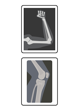 Lesmateriaal Ziek zijn: Röntgenfoto VS lichaamsfoto  van auteur JufkeSarah slide 2